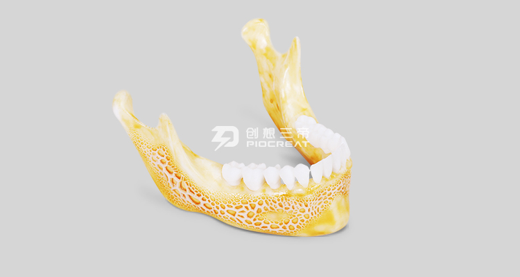 齿科3D打印机在口腔领域应用的优势