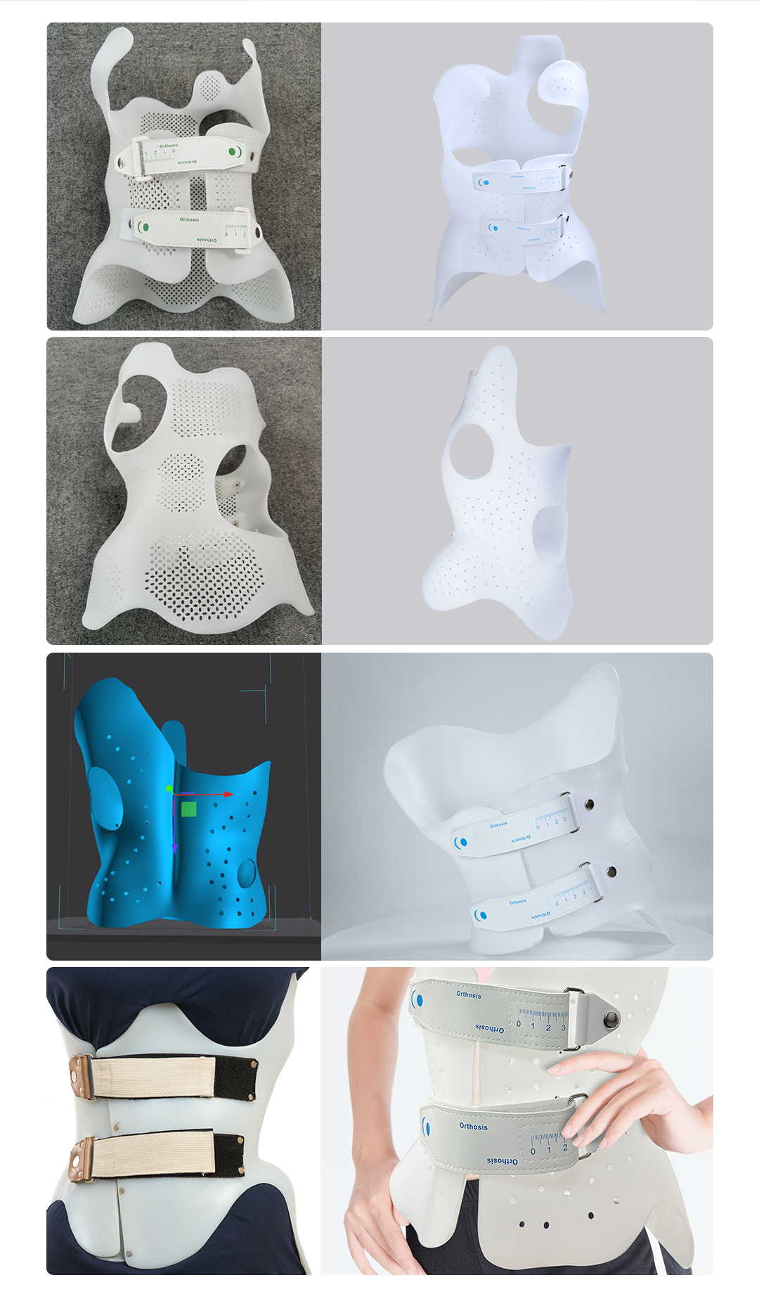 ms01 脊柱侧弯矫形支具3d打印机