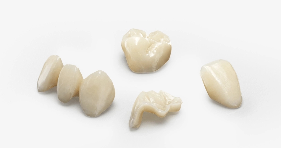 Veneers crowns inlays